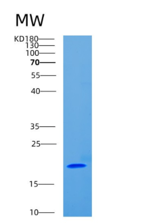 Recombinant Cluster Of Differentiation 8b (CD8b)