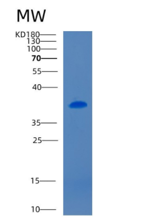 Recombinant Mouse CD5 antigen-like Protein