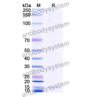 Anti-Clostridium botulinum botA/BOTOX Nanobody (SAA0929)