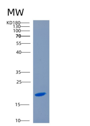 Recombinant Human CD70 Protein