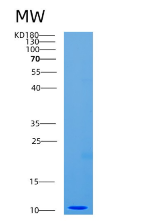 Recombinant Human CDC26 Protein