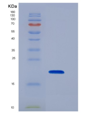 Recombinant Cluster of Differentiation 59 (CD59)