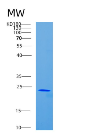 Recombinant Mouse CD80 Protein