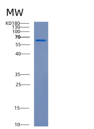 Recombinant Human CDH11 Protein