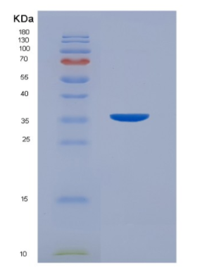 Eukaryotic Cluster Of Differentiation 7 (CD7)