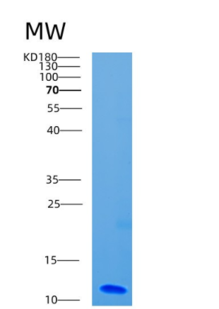 Recombinant Human CD9 Protein