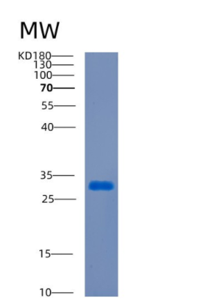 Recombinant Human CDCA8 Protein