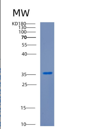 Recombinant Human CDK1 Protein.