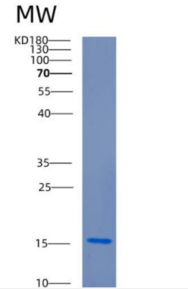 Recombinant Human CDC34 Protein.