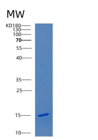 Recombinant Human CDKN2AIPNL Protein