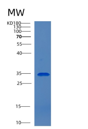 Recombinant Human CEACAM6 Protein