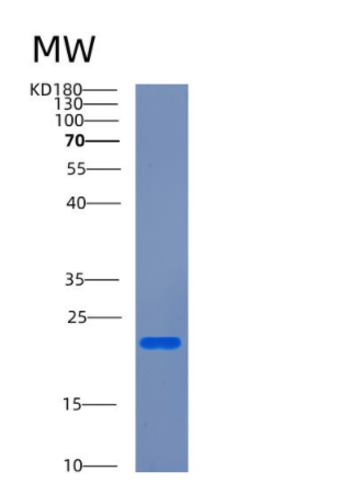 Recombinant Human CETN1 Protein