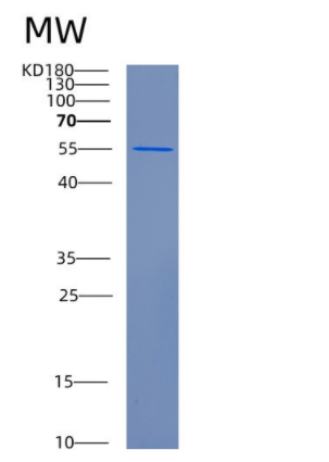 Recombinant Human CFLAR Protein