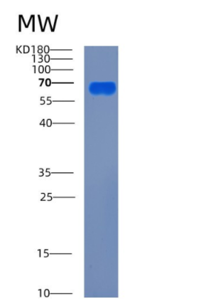 Recombinant Mouse Ces1g Protein