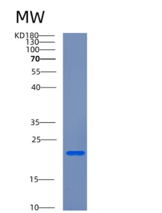 Recombinant Human CETN2 Protein