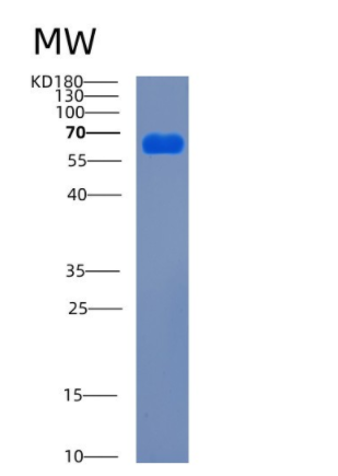 Recombinant Mouse Ces1d Protein