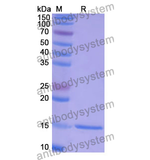 Anti-Human CCT5 Nanobody (SAA1374)