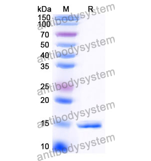 Anti-Clostridium botulinum botA/BOTOX Nanobody (SAA1350)