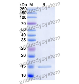 Anti-Human ERBB3/HER3 Nanobody (SAA1309)