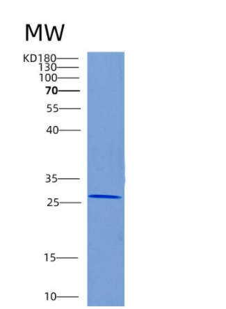 Recombinant Human CHMP2B Protein