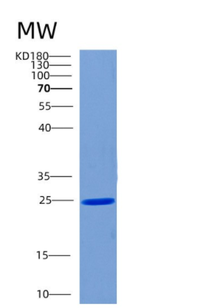 Recombinant Human CHMP1B Protein