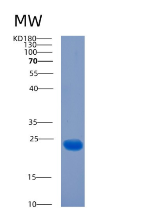 Recombinant Human CIB1 Protein