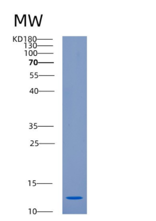Recombinant Human CKS1B Protein