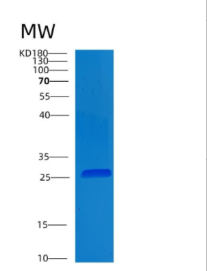 Recombinant Human CLMP Protein