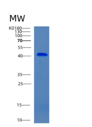 Recombinant Human CHST10 Protein