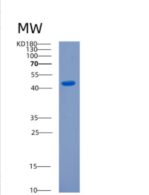 Recombinant Human CKMT1A Protein