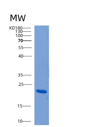 Recombinant Human CLEC4E Protein