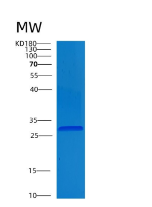 Recombinant Human CLIC4 Protein