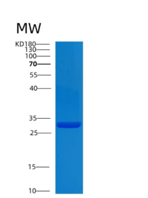 Recombinant Human CLIC2 Protein