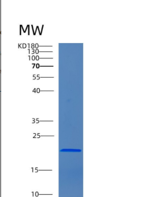 Recombinant Human CNBP Protein