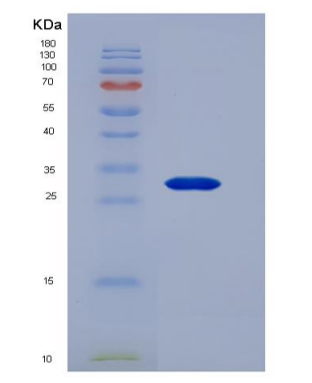 Recombinant Ciliary Neurotrophic Factor (CNTF)