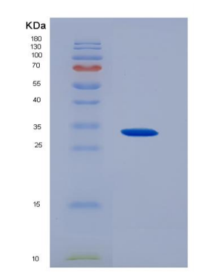 Recombinant Ciliary Neurotrophic Factor Receptor (CNTFR)