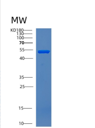 Recombinant Human CNDP2 Protein