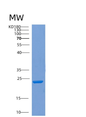 Recombinant Human COMMD7 Protein