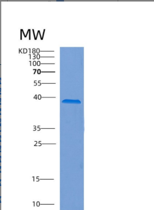 Recombinant Human COPE Protein