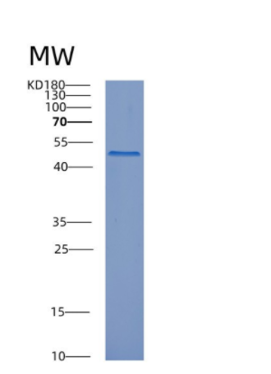 Recombinant Human CPE Protein