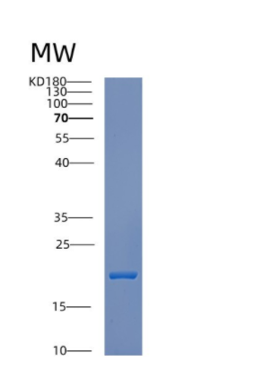 Recombinant Human CRCP Protein