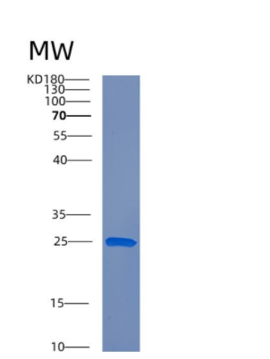 Recombinant Human CRK Protein