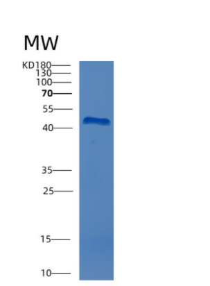 Recombinant Human CTH Protein