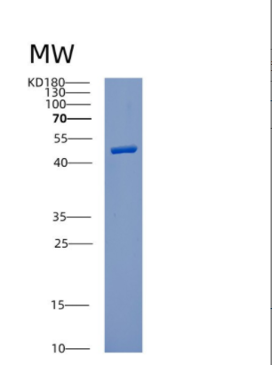 Recombinant Human CUL1 Protein