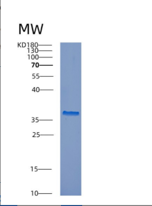 Recombinant Mouse Ctsl Protein