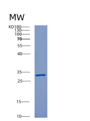 Recombinant Human CUTC Protein