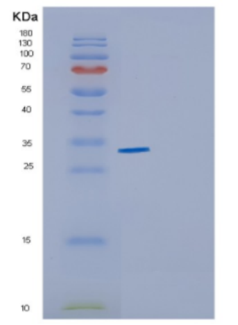 Recombinant Human CYB5R1 Protein