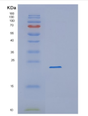 Recombinant Human CYGB Protein