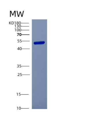 Recombinant Human CSTF1 Protein