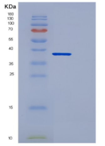 Recombinant Human DCN Protein